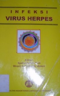 Image of Infeksi Virus Herpes