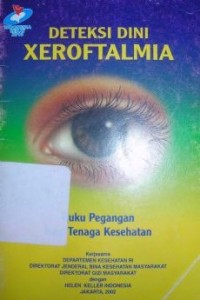 Image of Deteksi Dini Xeroftalmia
